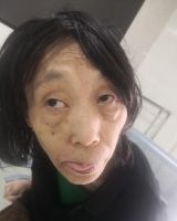 [女]约1959年出生2024年海南省救助省救191找家2409242100*