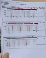 [女]寻找谢昌凤DNA数据