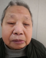 [女]约1941年出生2011年上海救助站救助的俞桂秀找家2111061121